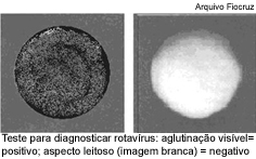Teste paar diagnosticar rotavírus: aglutinação visível= positivo; aspecto leitoso (imagem branca)= negativo
